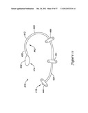 EPICARDIAL CLIP diagram and image