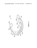 EPICARDIAL CLIP diagram and image