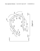 EPICARDIAL CLIP diagram and image