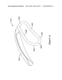 EPICARDIAL CLIP diagram and image