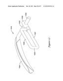 EPICARDIAL CLIP diagram and image