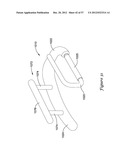 EPICARDIAL CLIP diagram and image