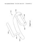 EPICARDIAL CLIP diagram and image