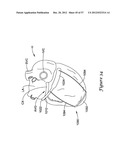 EPICARDIAL CLIP diagram and image