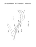 EPICARDIAL CLIP diagram and image