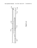 EPICARDIAL CLIP diagram and image