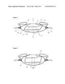 Intraocular Lenses for Variable Focus diagram and image