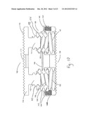 METHODS AND APPARATUSES FOR VERTEBRAL BODY DISTRACTION AND FUSION     EMPLOYING A COAXIAL SCREW GEAR SLEEVE MECHANISM diagram and image