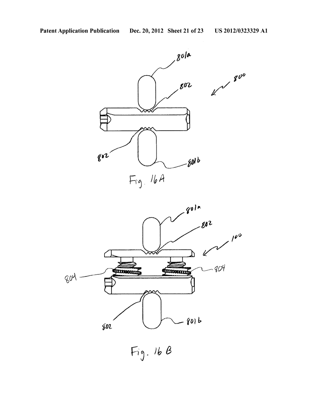 METHODS AND APPARATUSES FOR VERTEBRAL BODY DISTRACTION AND FUSION     EMPLOYING A COAXIAL SCREW GEAR SLEEVE MECHANISM - diagram, schematic, and image 22
