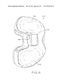 FEMORAL COMPONENT FOR A KNEE PROSTHESIS WITH IMPROVED ARTICULAR     CHARACTERISTICS diagram and image