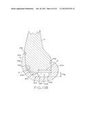 FEMORAL COMPONENT FOR A KNEE PROSTHESIS WITH IMPROVED ARTICULAR     CHARACTERISTICS diagram and image