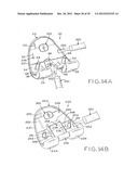 FEMORAL COMPONENT FOR A KNEE PROSTHESIS WITH IMPROVED ARTICULAR     CHARACTERISTICS diagram and image