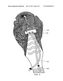 HAIR EXTRACTION APPARATUS diagram and image