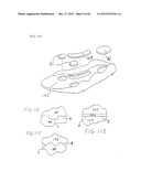 SHOE SOLE ORTHOTIC STRUCTURES AND COMPUTER CONTROLLED COMPARTMENTS diagram and image