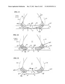 SHOE SOLE ORTHOTIC STRUCTURES AND COMPUTER CONTROLLED COMPARTMENTS diagram and image