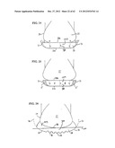 SHOE SOLE ORTHOTIC STRUCTURES AND COMPUTER CONTROLLED COMPARTMENTS diagram and image