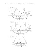 SHOE SOLE ORTHOTIC STRUCTURES AND COMPUTER CONTROLLED COMPARTMENTS diagram and image