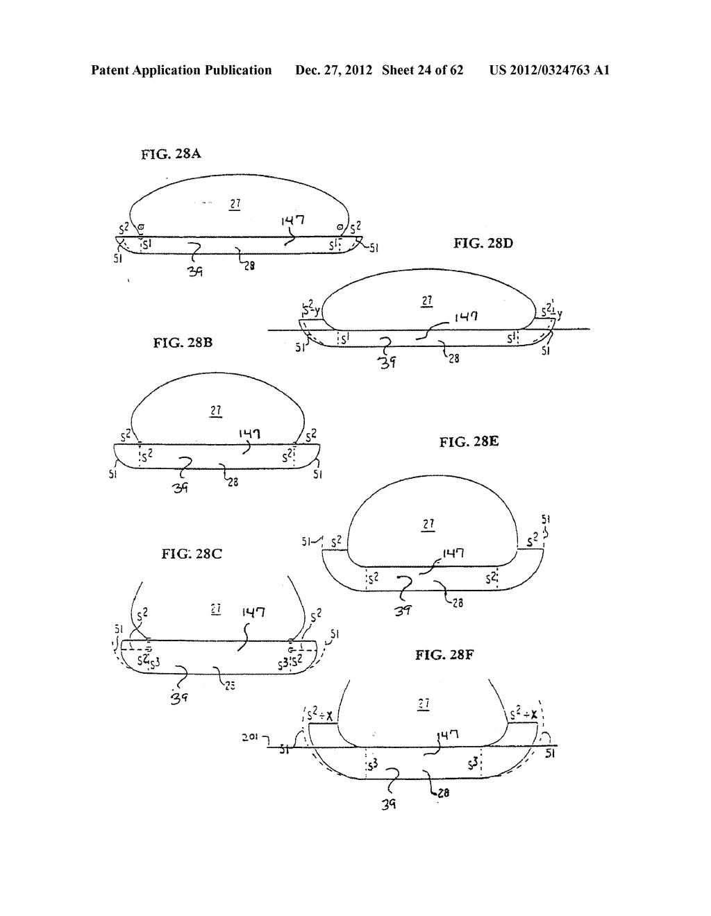 SHOE SOLE ORTHOTIC STRUCTURES AND COMPUTER CONTROLLED COMPARTMENTS - diagram, schematic, and image 25
