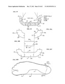 SHOE SOLE ORTHOTIC STRUCTURES AND COMPUTER CONTROLLED COMPARTMENTS diagram and image