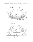 SHOE SOLE ORTHOTIC STRUCTURES AND COMPUTER CONTROLLED COMPARTMENTS diagram and image