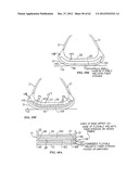 SHOE SOLE ORTHOTIC STRUCTURES AND COMPUTER CONTROLLED COMPARTMENTS diagram and image