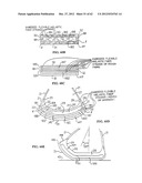 SHOE SOLE ORTHOTIC STRUCTURES AND COMPUTER CONTROLLED COMPARTMENTS diagram and image