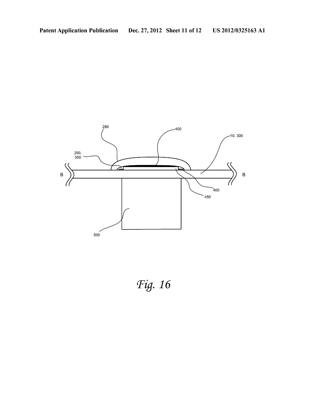 Pet Protective Collar With Stays - diagram, schematic, and image 12