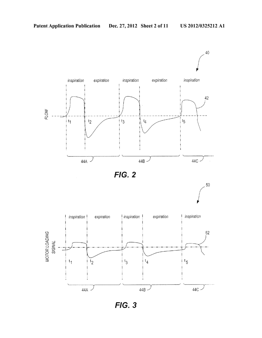 Method And Apparatus For Providing Positive Airway Pressure To A Patient - diagram, schematic, and image 03