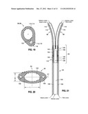 VENTILATION MASK WITH INTEGRATED PILOTED EXHALATION VALVE diagram and image