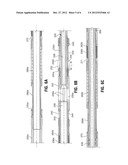 FRACTURING PORT LOCATOR AND ISOLATION TOOL diagram and image