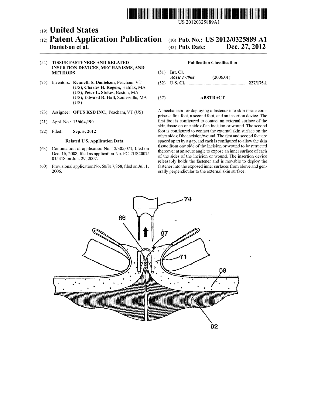 TISSUE FASTENERS AND RELATED INSERTION DEVICES, MECHANISMS, AND METHODS - diagram, schematic, and image 01