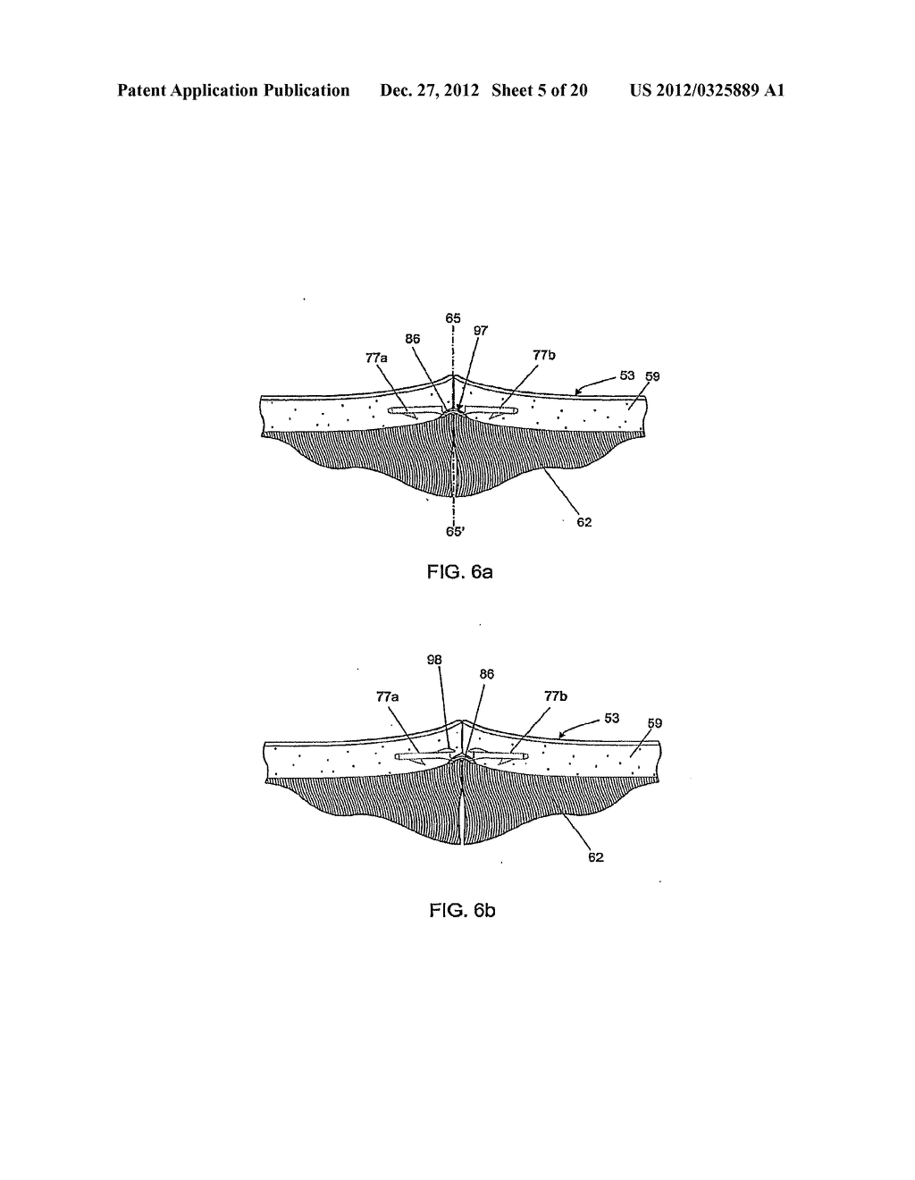 TISSUE FASTENERS AND RELATED INSERTION DEVICES, MECHANISMS, AND METHODS - diagram, schematic, and image 06