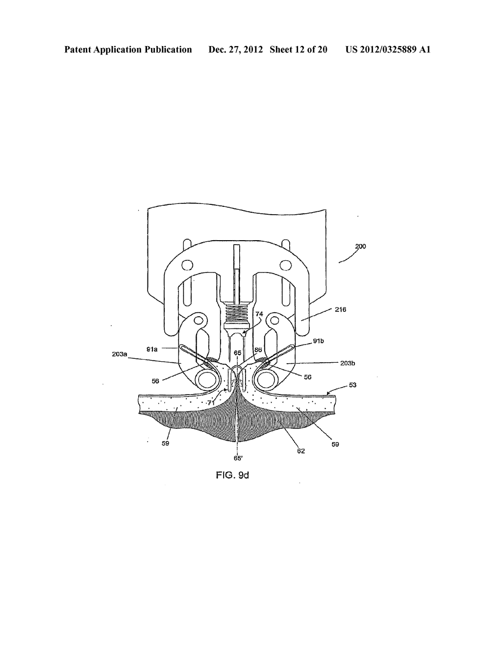 TISSUE FASTENERS AND RELATED INSERTION DEVICES, MECHANISMS, AND METHODS - diagram, schematic, and image 13