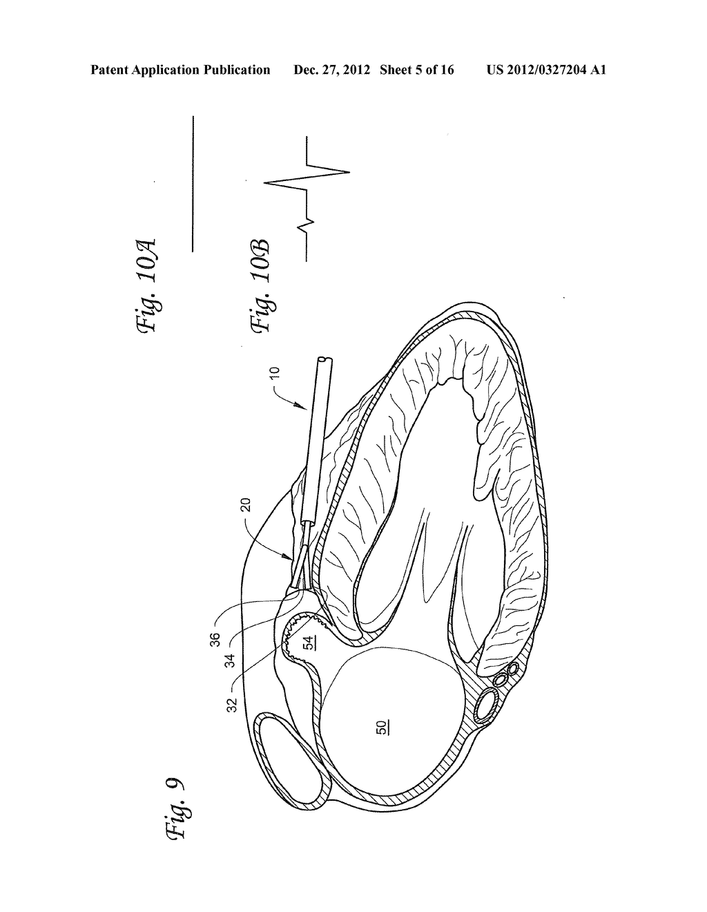 ENHANCED SIGNAL NAVIGATION AND CAPTURE SYSTEMS AND METHODS - diagram, schematic, and image 06