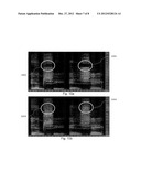 Processing of Audio Signals During High Frequency Reconstruction diagram and image