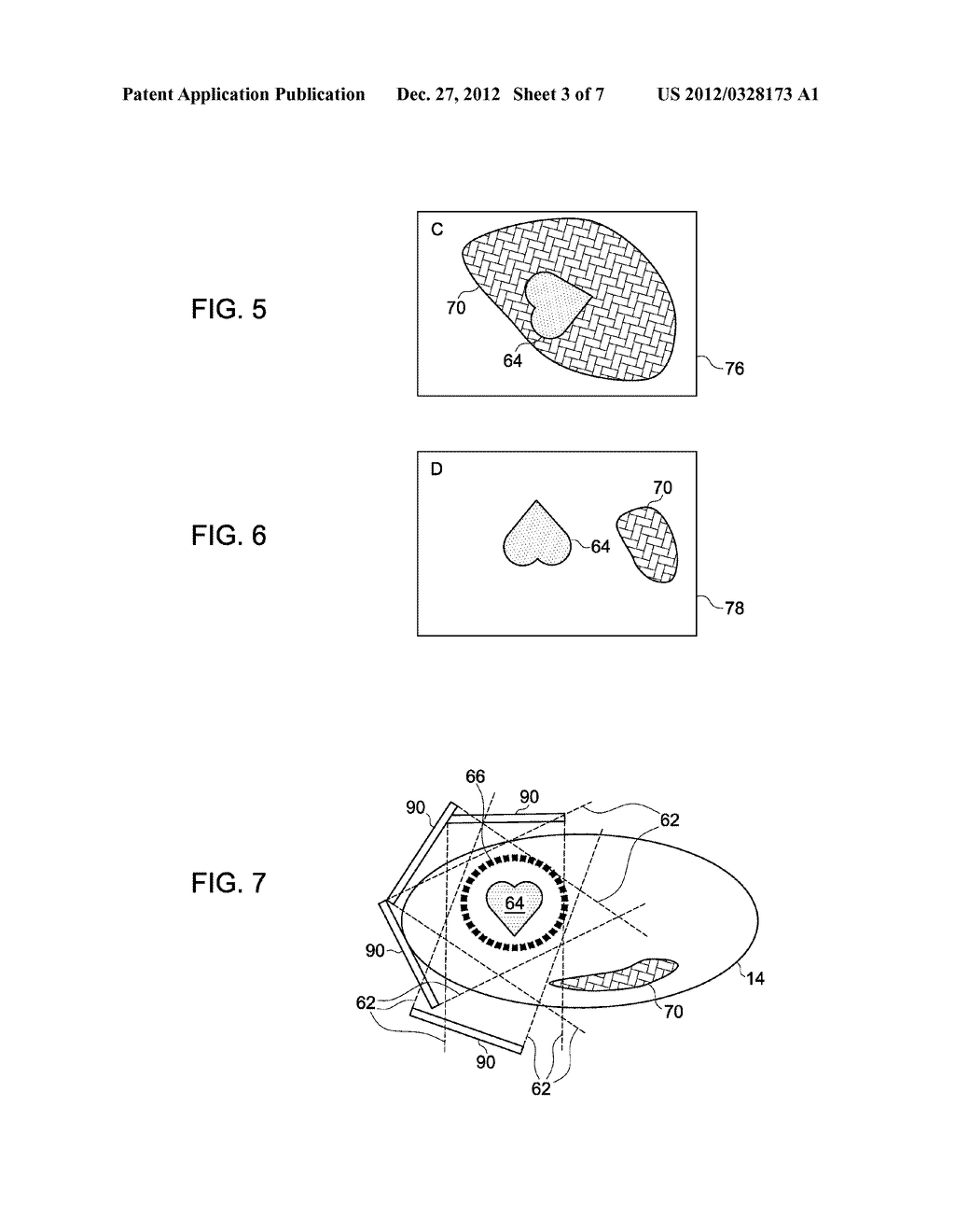 ARTIFACT REMOVAL IN NUCLEAR IMAGES - diagram, schematic, and image 04