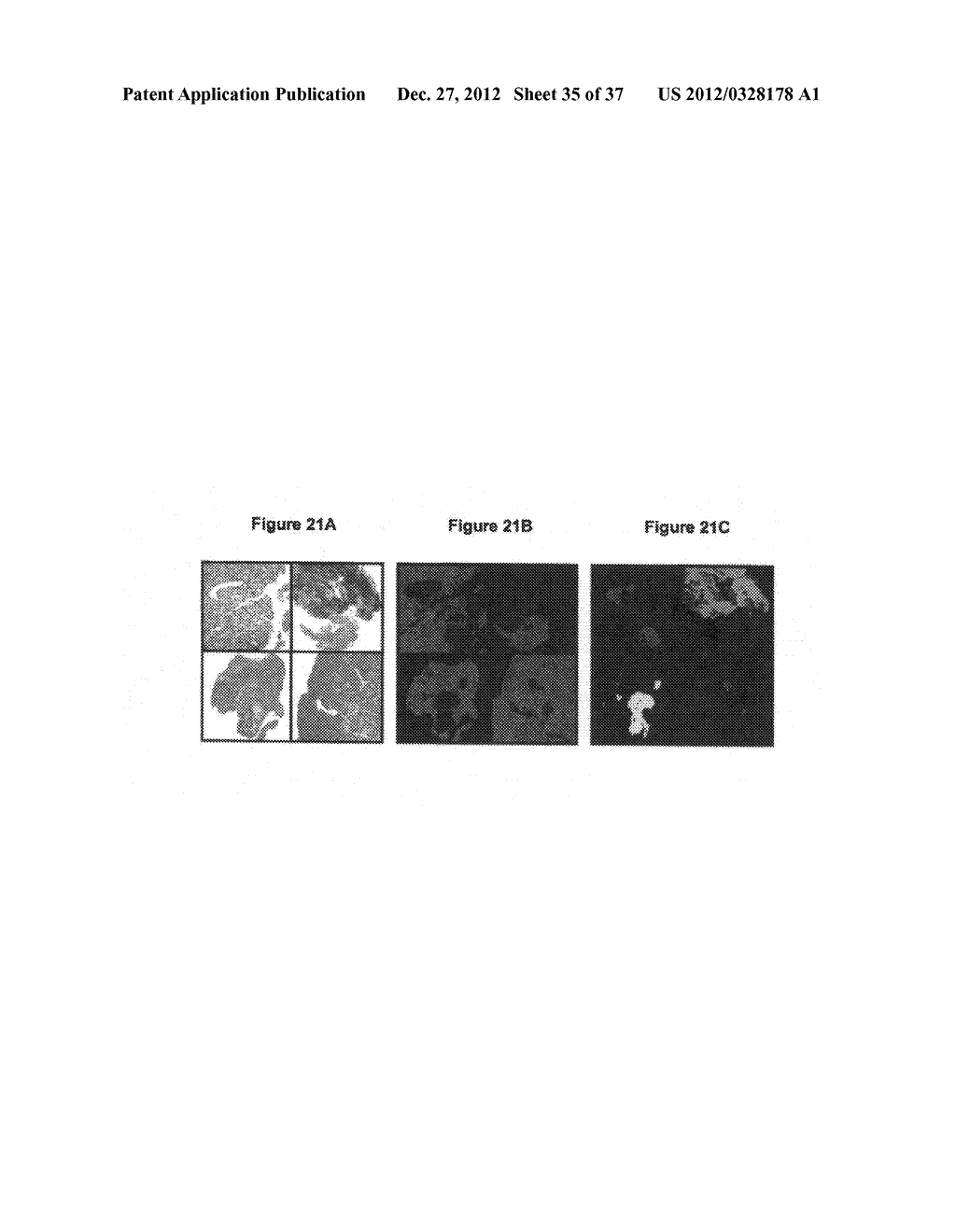 Method for analyzing biological specimens by spectral imaging - diagram, schematic, and image 36