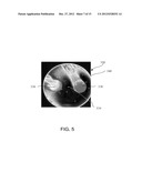 APPARATUS AND METHODS FOR THE DETERMINATION OF A BIREFRINGENCE AXIS OF A     POLARIZATION-MAINTAINING OPTICAL FIBER diagram and image