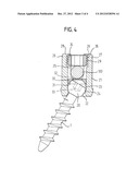 ELEMENT WITH A SHANK AND A HOLDING ELEMENT CONNECTED TO IT FOR CONNECTING     TO A ROD diagram and image