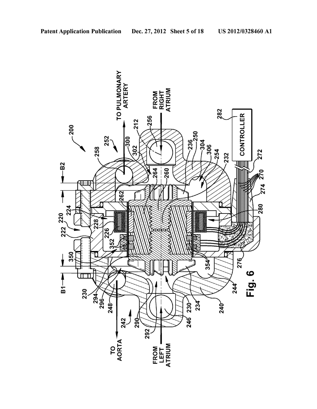 TWO-STAGE ROTODYNAMIC BLOOD PUMP - diagram, schematic, and image 06