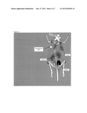 PROSTATE SPECIFIC MEMBRANE ANTIGEN INHIBITORS diagram and image