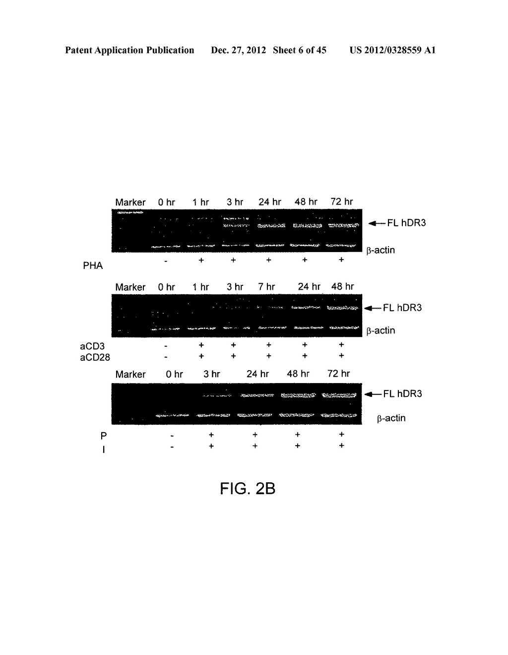 Compositions and Methods for Treating Inflammatory Lung Disease - diagram, schematic, and image 07