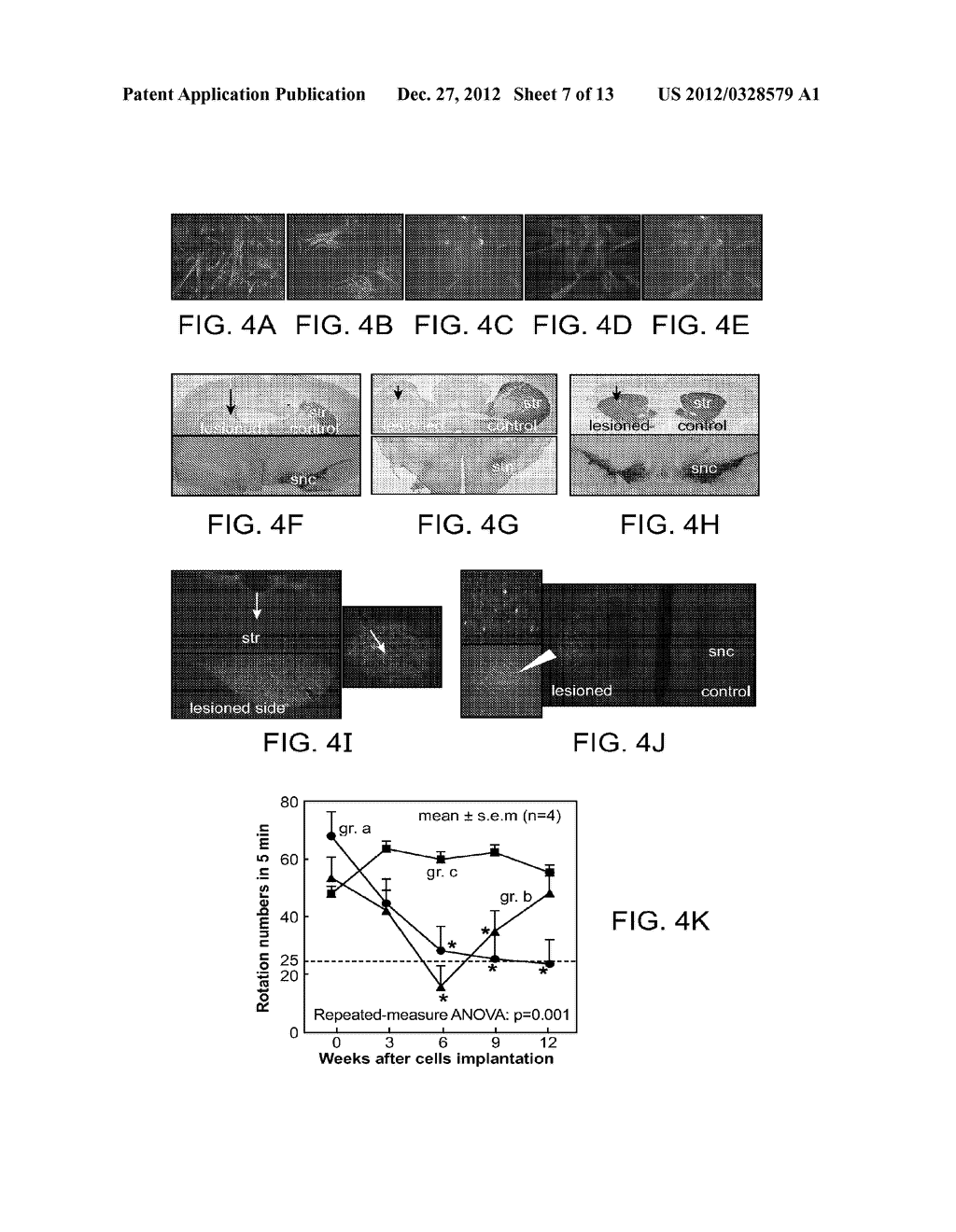 HUMAN TROPHOBLAST STEM CELLS AND USE THEREOF - diagram, schematic, and image 08