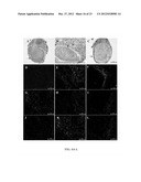 TREATMENT OF PAIN USING PLACENTAL STEM CELLS diagram and image