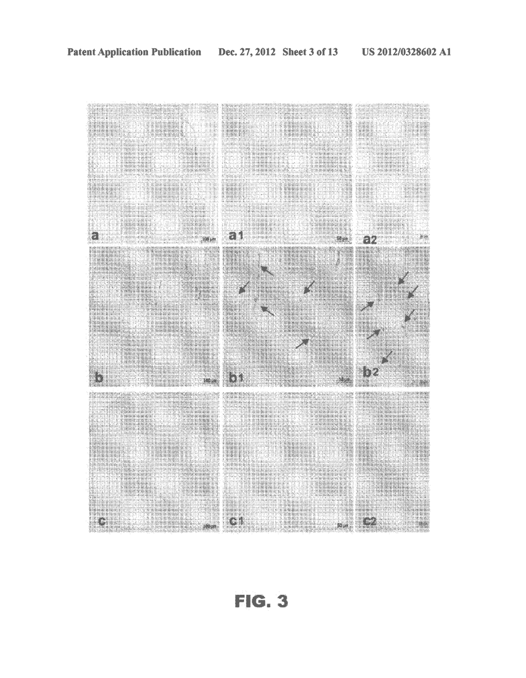 COMPOSITIONS AND METHODS FOR TREATING CONDITIONS ASSOCIATED WITH CERAMIDE     BIOSYNTHESIS - diagram, schematic, and image 04