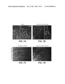 Modulation of Axon Degeneration diagram and image