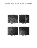 Modulation of Axon Degeneration diagram and image