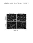 Modulation of Axon Degeneration diagram and image