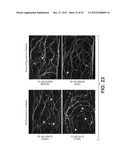 Modulation of Axon Degeneration diagram and image