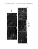 Modulation of Axon Degeneration diagram and image